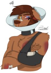  2022 absurd_res alpha_channel anthro bandage bandage_on_face bandage_on_nose bandaged_arm black_eye_(injury) blood blood_on_face blue_eyes bodily_fluids broken_arm bruised bruised_arm bruised_chest bruised_eye bruised_face canid canine canis cast collar cone_of_shame digital_media_(artwork) eye_roll fluffy_chest half-length_portrait hi_res male mammal mature_male medical_instrument nosebleed portrait scientific_instrument simple_background sling_(medicine) solo thomas_ii_(zer0rebel4) transparent_background were werecanid werecanine wolf wounded yellow_sclera zer0rebel4 