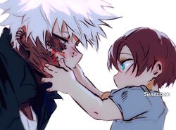  2boys aged_down artist_name blood blue_eyes boku_no_hero_academia brothers burn_scar cheek_piercing dabi_(boku_no_hero_academia) english_commentary lolicon looking_at_another male_focus multicolored_hair multiple_boys multiple_scars piercing profile red_hair scar scar_on_face scar_on_neck sharl0ck siblings simple_background split-color_hair spoilers staple stapled todoroki_shouto todoroki_touya two-tone_hair white_background white_hair 